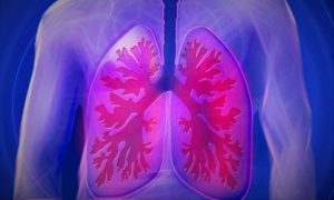 upper body, lung, copd